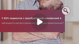 Диагностика приобретенной гемофилии А
