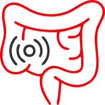 Ойық жаралы колит (ОЖК)